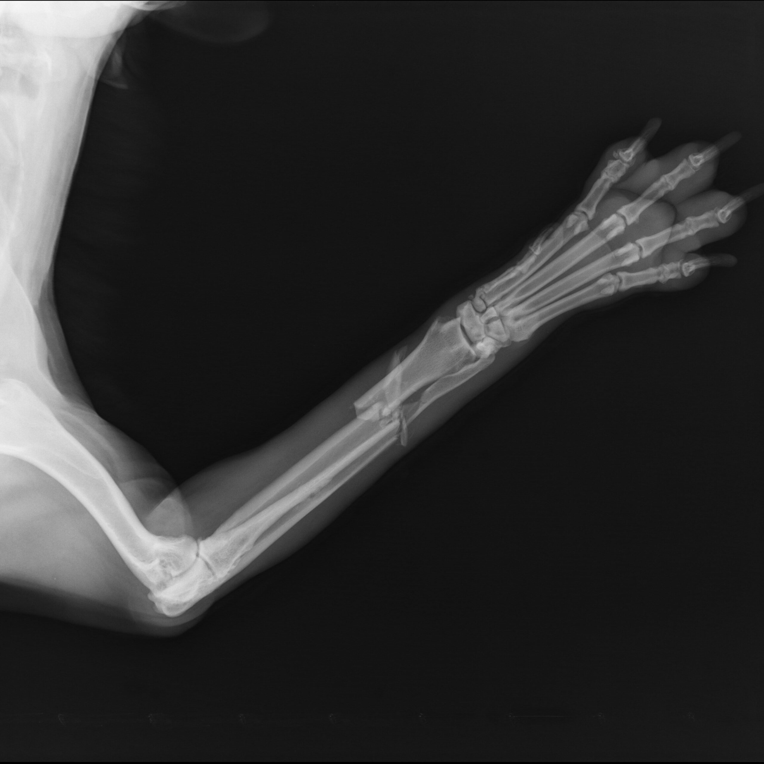 Radiografia veterinaria digitale che mostra una frattura dell'arto anteriore di un cane, eseguita presso il pronto soccorso dell'ospedale veterinario a Verona.